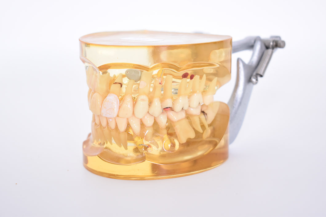 Schaumodell, für Zahnersatz Dental