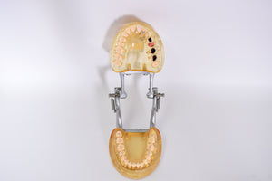 Schaumodell, für Zahnersatz Dental