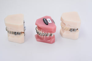 Schaumodell, Dentaurum Dental, Zahntechnik
