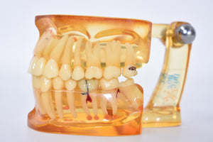 Schaumodell, Zahnmodell, für Zahnersatz Vorgearbeitet