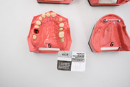 Go-Dent Schaumodell mit Koffer , Dental, Zahntechnik